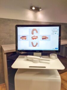 Digitaler Zahnabdruck mit Intraoralscanner in der Zahnarztpraxis Menke Kinzel Warstein Sichtigvor